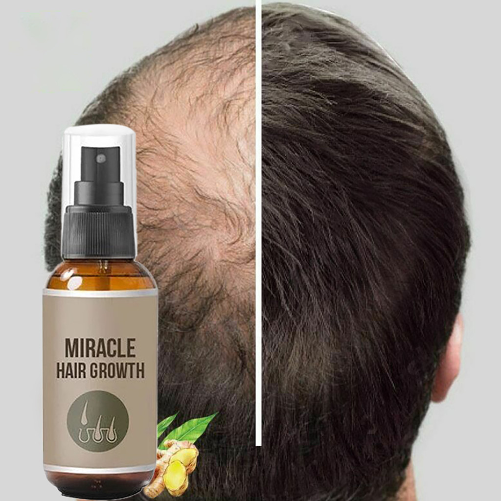 New 30/50ml Hair Growth Spray Ginger Essence Spray Effective Extract Anti Hair Loss Nourish Roots Prevent Hair Loss Grow Hair