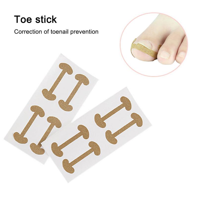 4pcs Effiective Toe Nail Corrector Deformation Meat Bag Ingrown Toenail Tool Orthodontic Thumb Nail Roll Patch Foot Care Device