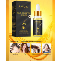 Women Men 20ml Ginger Fast Hair Growth Serum Essential Oil Anti Preventing Hair Loss Treatment Damaged Hair Repair Growing