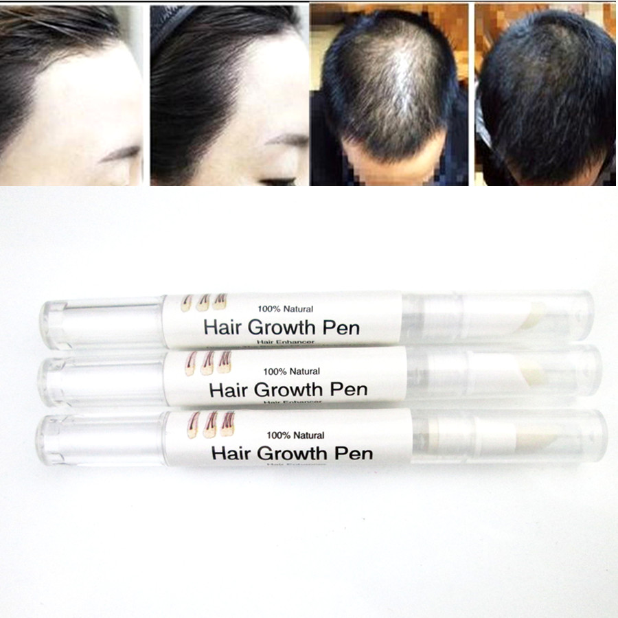 natural faster Grow 5% mino Hair Growth regrowth oil tonic serum products rajout cheveux cure Products Stop Hair Loss treatment