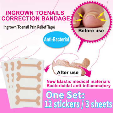 12pcs ingrown toenails band Aid relief pain Paronychia correction pedicure Elastic Force Sticker Repair bandage toe nail care