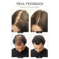 Hair Growth Essence Oil Anti Hair Loss for Hair Growth Treatment for Hair Loss Thickner Hair Tonic Hair Serum Hair Care Products
