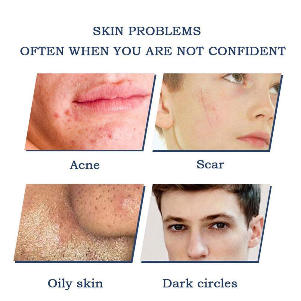 50ml Men's Face Cream Concealer Acne Marks BB Cream Men's Special Natural Color Light Makeup Liquid Foundation Drop Ship