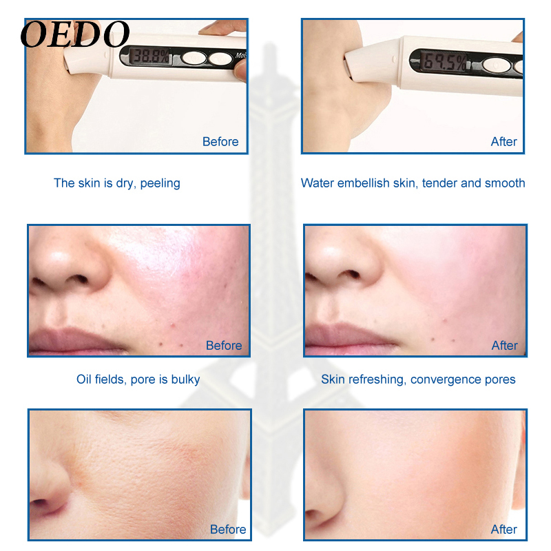 OEDO Rose Peptide Nourish Clear Toner Skin Care Whitening Moisturizing Acne Treatment Black Head Anti Wrinkle Ageless 100ml