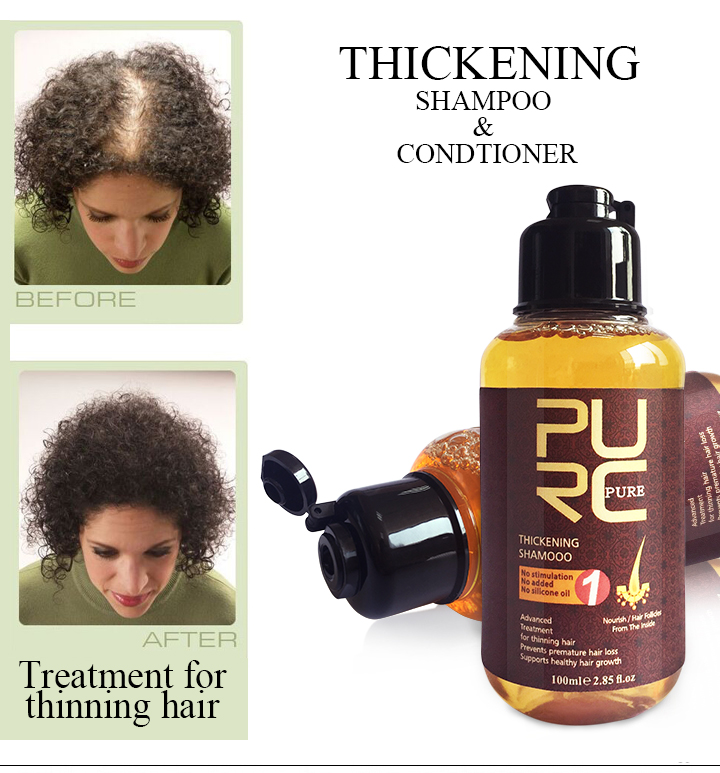 Herbal Ginseng Hair Care Essence Treatment For Hair Loss Help Hair Regrowth Serum Repair Hair root Thicken Hair Shampoo