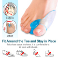 2Pcs Big Toe Separator Bone Corrector Straightener Soft Silicone Gel Foot Fingers Protector Bunion Adjuster Feet Massager