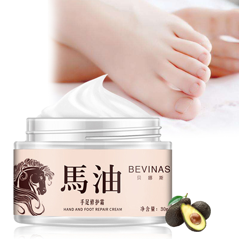 Horse Oil Anti Fungal Foot Cream Relieve Beriberi Anti Dry Crack Repair Moisturizing Feet Treatment Fungal Infection Skin Care