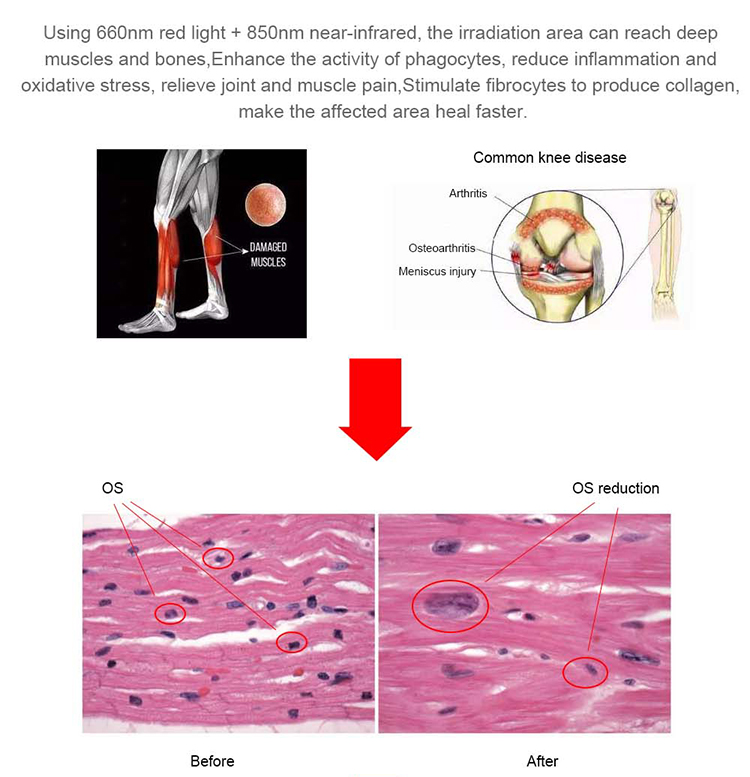 Red Light Therapy Bed Benefits