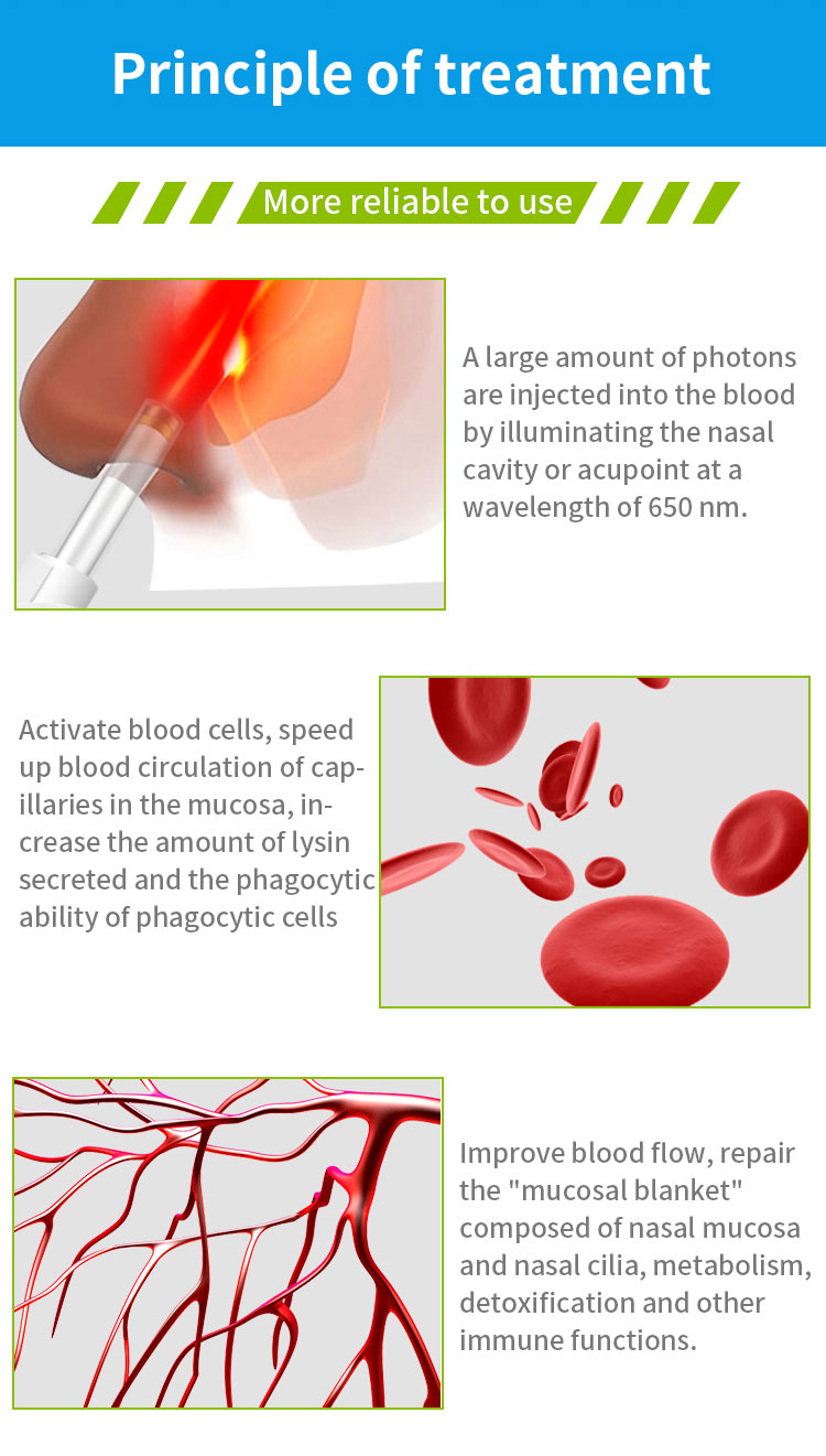 productive cough laser treatment