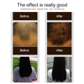 PURC Hot Fast Growth Hair Essence Essential Oil Liquid Treatment Preventing Hair Loss And Hair Grwoth Spray Hair Care 30ml TSLM2