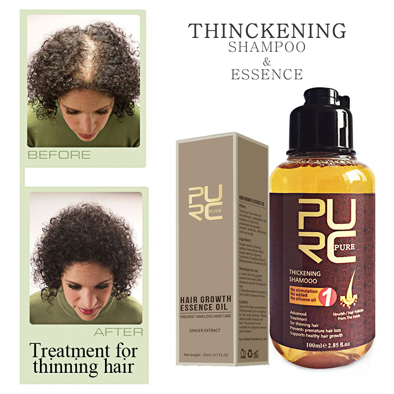 PURC Narutal Ginger Hair Growth Shampoo & Essence Oil Baldness Fast Help Strengthen Prevent Hair Loss Hair Treatment Care Set