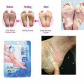 Milk To The Dead Skin Film To Remove Keratin, Old Cockroaches Reveal Baby Foot And Foot Care Tender Slippery Foot Film