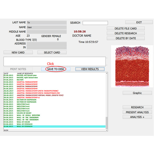 bioresonance 8d nls health analyzer scanning equipment for Sale, bioresonance 8d nls health analyzer scanning equipment wholesale From China