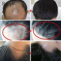 Herbal Hair Growth Essence Hair Repair Treatment Liquid Regrowth Essential Oil Serum Preventing Hair Loss Fast Restoratio Care