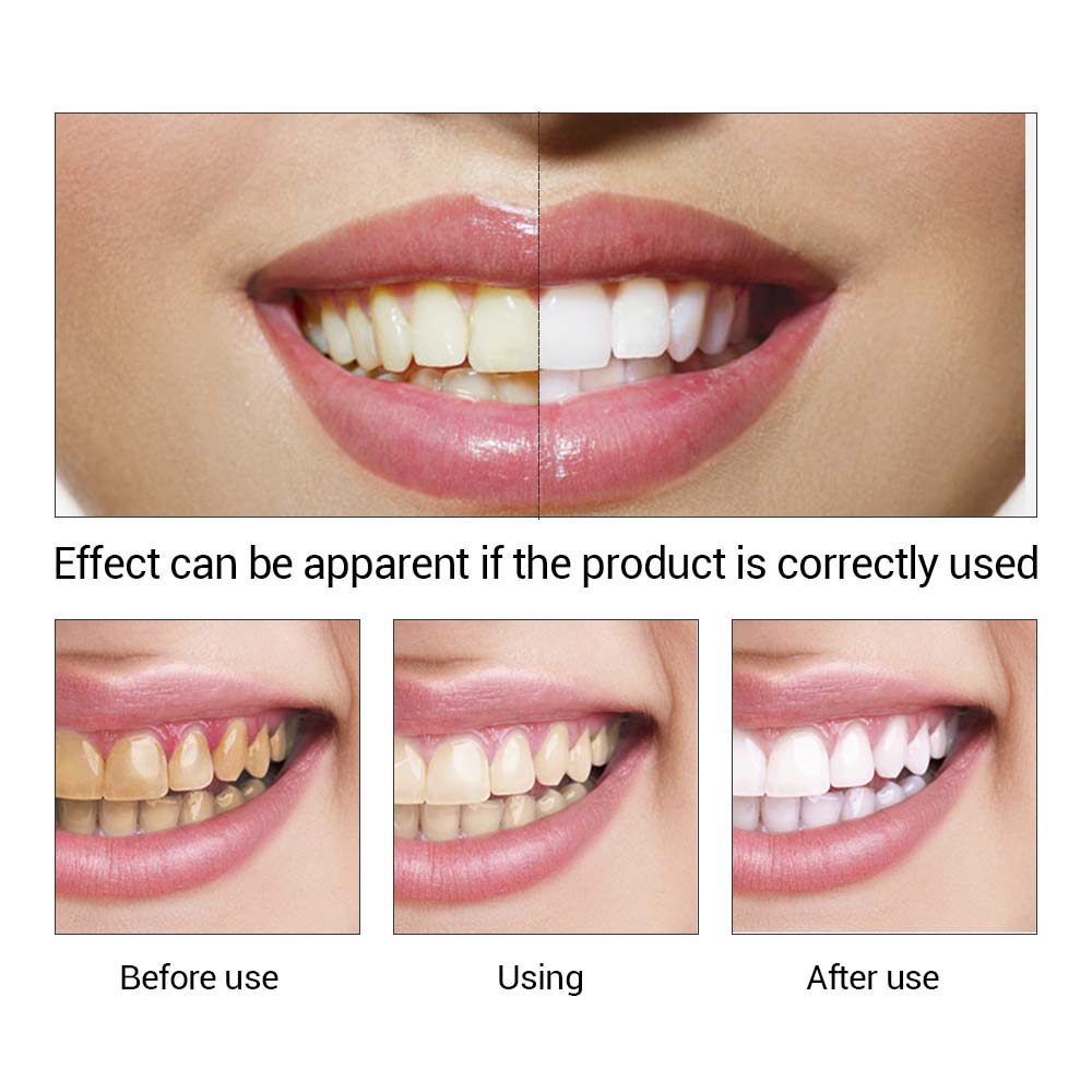 LANBENA Teeth Whitening Essence Powder Oral Hygiene Cleaning Serum Removes Plaque Stains Bleaching Dental Tools