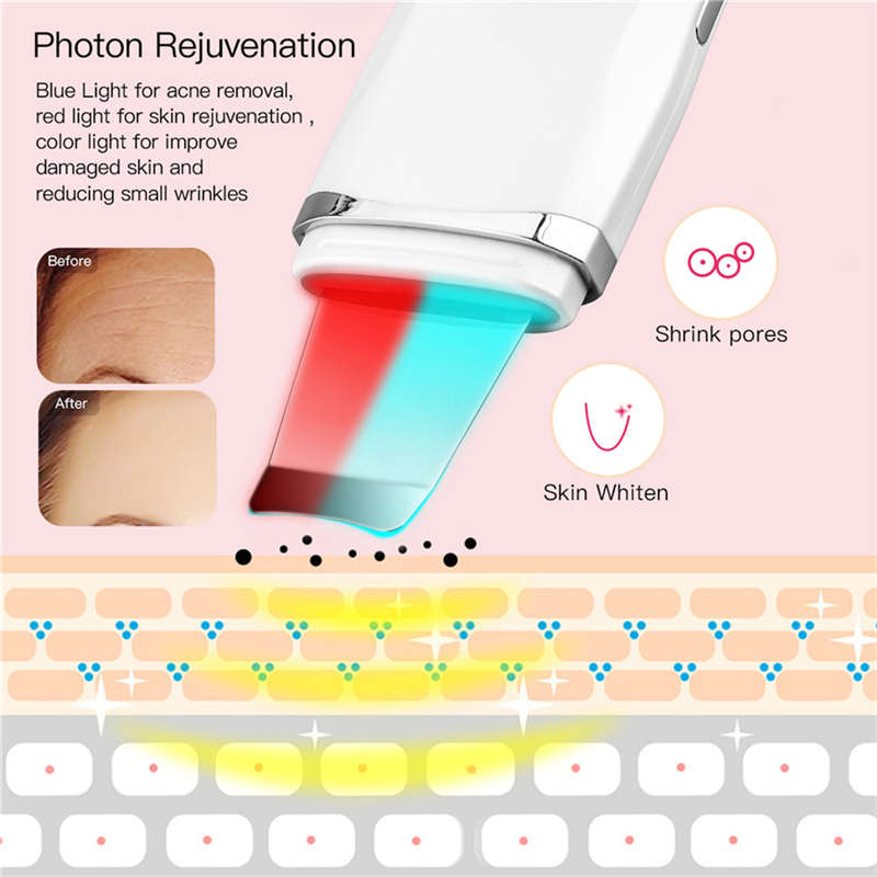 CkeyiN Red Blue LED Photon Skin Scrubber Light Therapy Deep Cleaning Vibration Massager Acne Blackhead Removal Face Peeling Tool