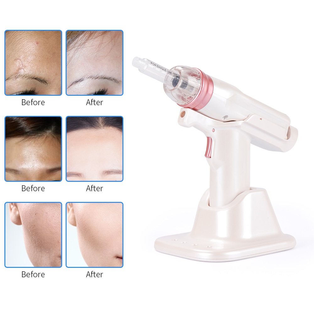 Hydrolifting Gun Korea Mesotherapy EZ Negative Pressure Meso gun Mesotherapy Hydrolifting Water Injector Beauty Device