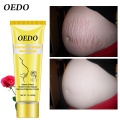 OEDO Rose Remove Stretch Mark Cream Nourish Moisturizing Anti-wrinkle Pregnant Women Skin Repair Remove Obesity Tattoo Body Care