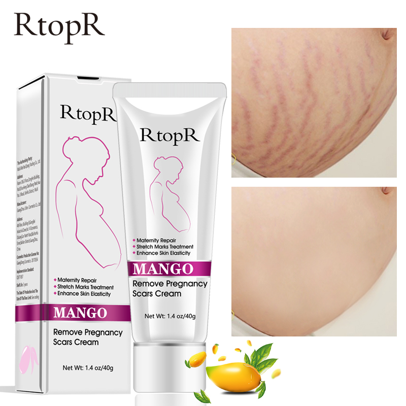 New Remove Pregnancy Scars Cream Maternity Pigment Correction Repair Body Gel Firming Lifting Brighten Stretch Marks RtopR 40g
