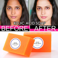 Dark Black Skin Lightening Soap Kojic Acid Whitening Soap Kojic Acid Glycerin Brighten Face Body Skin Bleaching Soap