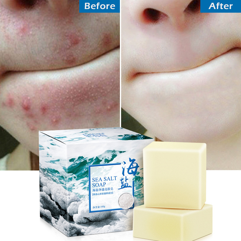 100g Sea Salt Soap Goat Milk Remove Acne Oil-Control Clean Skin Shrinks Pores Whitening Cleanser Blackhead Remover Natural