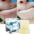 100g Sea Salt Soap Goat Milk Remove Acne Oil-Control Clean Skin Shrinks Pores Whitening Cleanser Blackhead Remover Natural