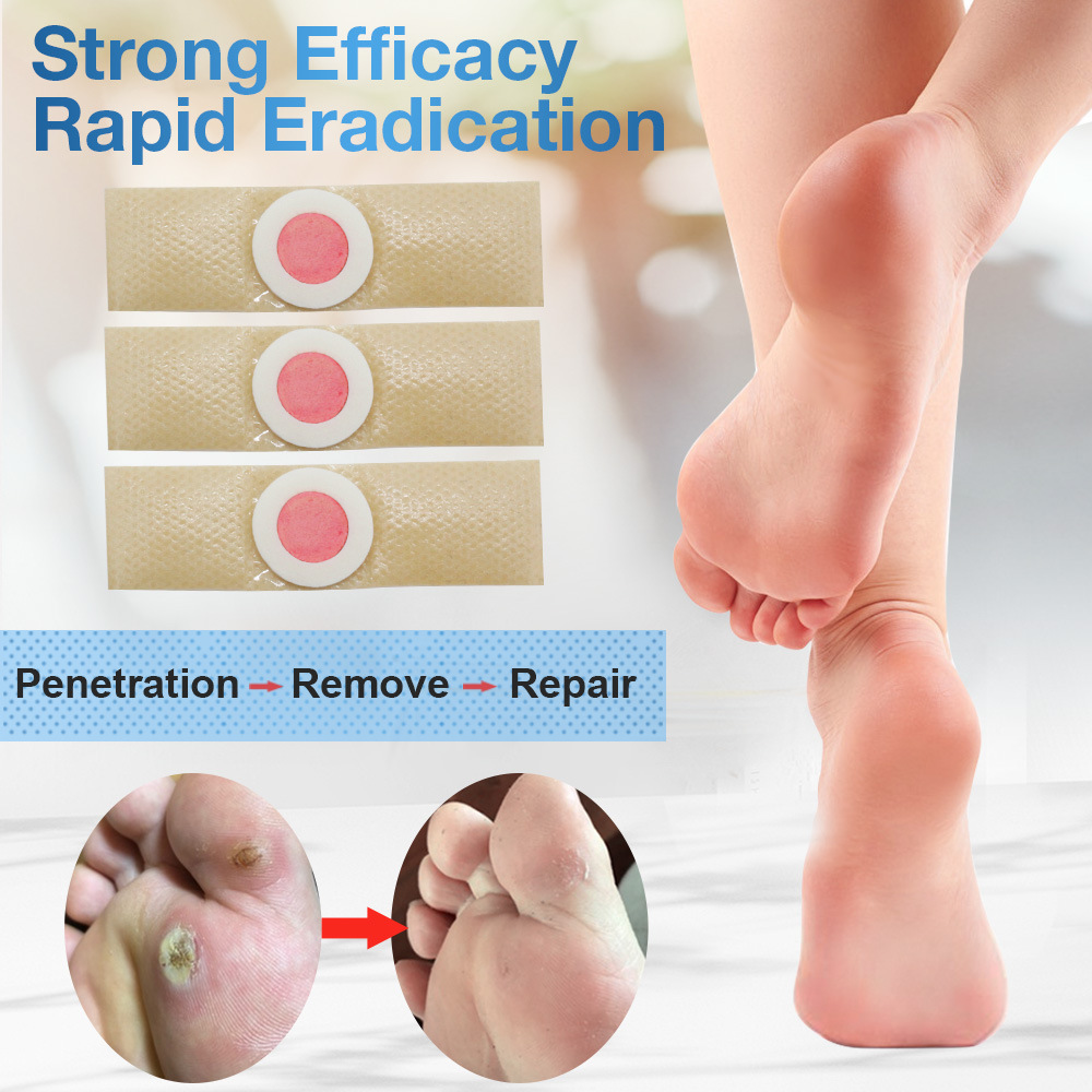 24pcs/1Box Foot Corn Removal Medical Plaster Warts Thorn patches Corn of foot Calluses Callosity Detox clavus Medical Patch