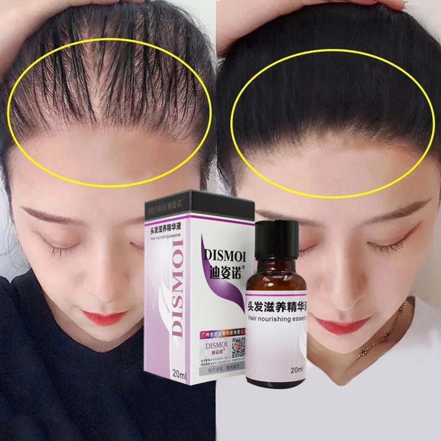 LAIKOU Hair Care Scalp Treatments Nutrition Hair Essential Oil Fast Powerful Hairs Growth Serum Repai Loss Fast Hairs Mask Care