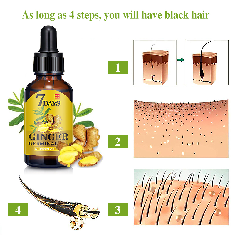 30ml 7Day Ginger Germinal Oil Fast Hair Growth Serum Essential Oil Natural Hair Loss Treatement Effective Fast Growth Hair Care