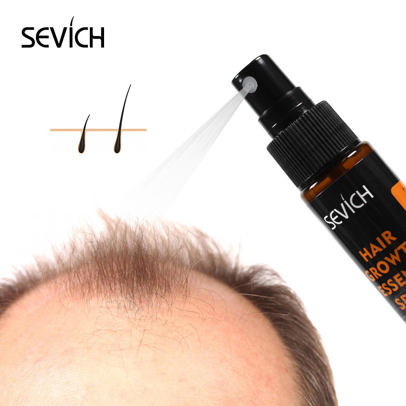 Sevich 30ml Hair Growth Essence Spray Hair Lose Liquid Damaged Hair Repair Growing Original Authentic Hair Loss Treatment