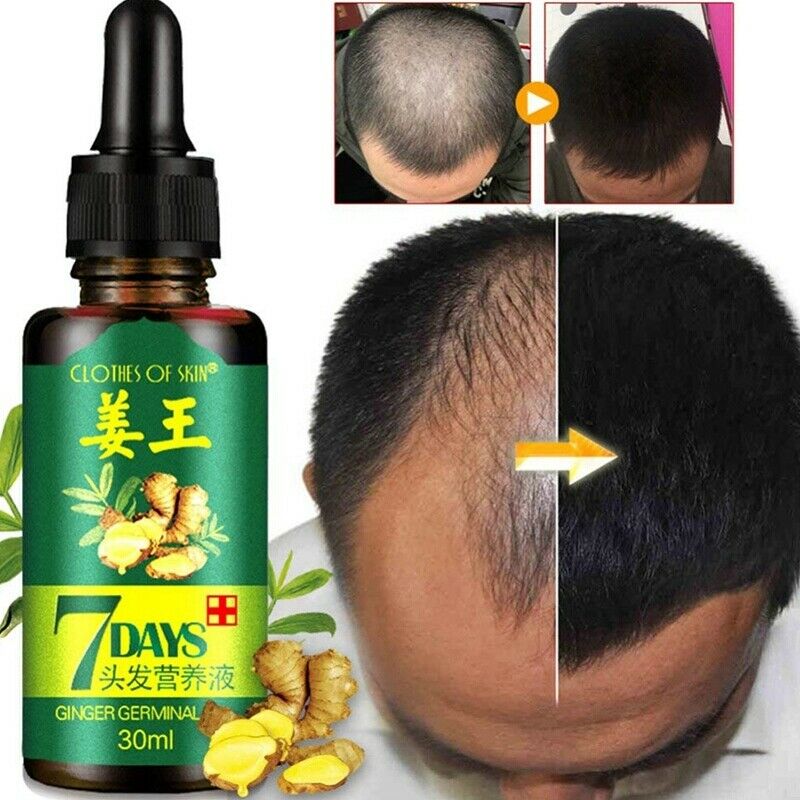 Grape Seed Oil Hair Essential Oil Eyelashes Eyebrow Growth Prevent Skin Aging Serum Hair Fast Growth Liquid Hair Loss Treatment