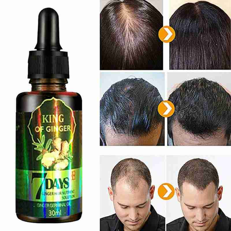 30ml Ginger Hair Growth Nutrient Solution Hair Loss Nutrition Moisturizing Treatment Repairing Essential Oil Scalp Protecti H0I3