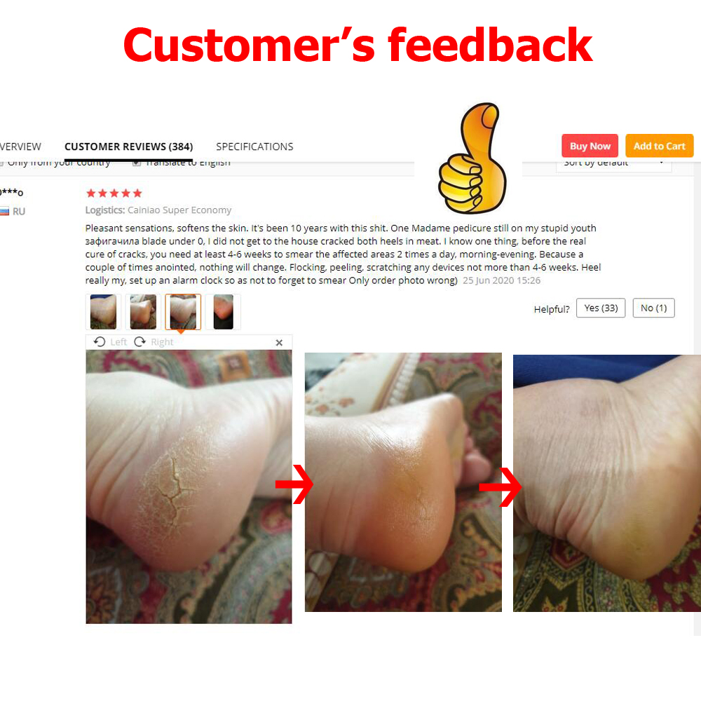 Powerful Traditional Chinese 33g Anti-Drying Crack Foot Cream Heel Cracked Repair Cream Removal Dead Skin Hand Feet Care