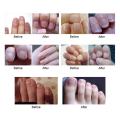 New Chinese Cream Nails Finger Toe Protector Fungus Treatment Herb Health Tools Onychomycosis Paronychia Infection Skin Care