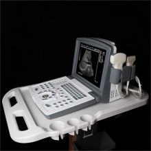 Hot Sale Full Digital Diagnostic Ultrasound Scanner