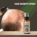 New 30/50ml Hair Growth Spray Ginger Essence Spray Effective Extract Anti Hair Loss Nourish Roots Prevent Hair Loss Grow Hair