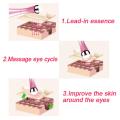 Electric Vibration Eye Massager Anti Wrinkle Eye Massage Anti Aging Eye Care Massage Device Removal Dark Circle Beauty Devices