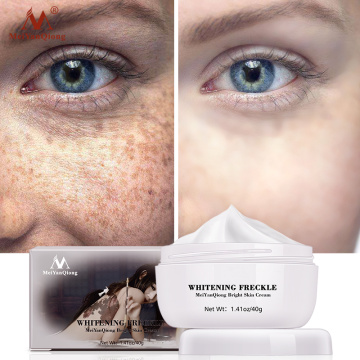 Meiyanqiong Anti Aging Face Care Cream Dark Spot Remover Skin Lightening Cream Dark Skin Care Anti Freckle Whitening Cream