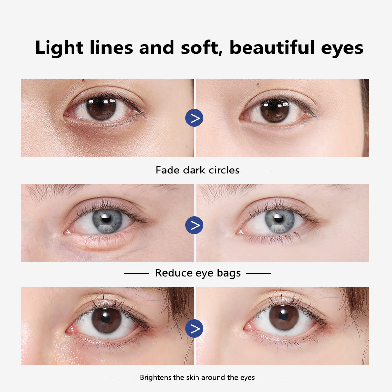 Vitamin A Eye Cream Anti-Wrinkle Anti-Age Remove Dark Circles Eye Care Massage Rolling Eye Cream Skin Care Eye Mask Cream TSLM1