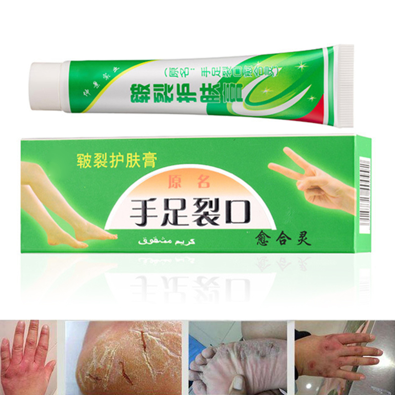 Hand Foot Crack Cream Heel Chapped Peeling Repair Anti Dry Crack Winter Feet Care Ointment ZGOOD