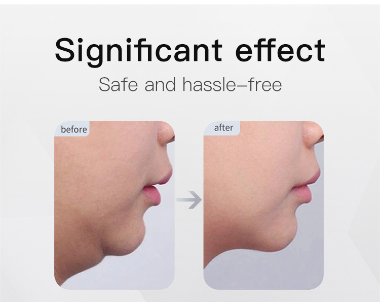 rf facial machine