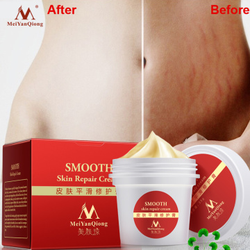 High Quality Smooth Skin Cream For Stretch Marks Scar Removal To Maternity Skin Repair Body Cream Remove Scar Care Postpartum