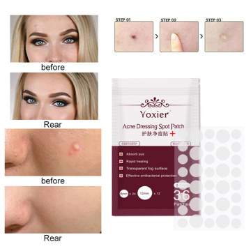 36Pcs Acne Pimple Patch Invisible Acne Stickers Effectively Remove Pimples Acne Treatment Mask Skin Concealer Tags Makeup Tools