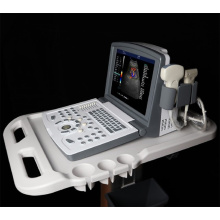 Portable Color Doppler Ultrasound Scanner for Vascular