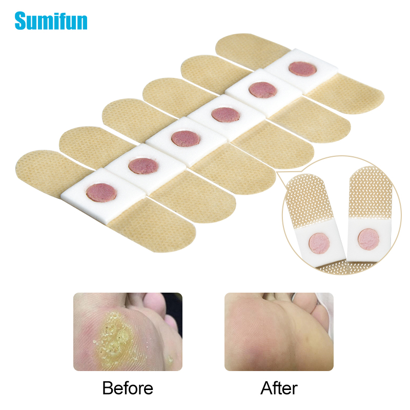 12/24/36Pcs Foot Corn Remover Painless Feet Care Patch Warts Thorn Medical Plaster Feet Callus Removal Tool Soften Skin D2399