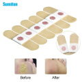 12/24/36Pcs Foot Corn Remover Painless Feet Care Patch Warts Thorn Medical Plaster Feet Callus Removal Tool Soften Skin D2399