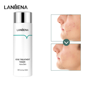 LANBENA Oligopeptide Anti-acne Acne Treatment Toner Deep Moisturizing Plant Extracts Soothes Repair Fine Lines Oily Rough Skin