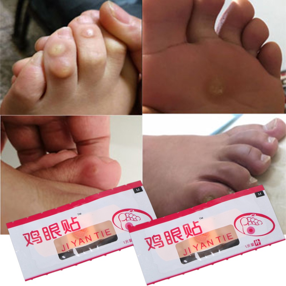 6Pcs Foot Patch Corn Treatment Removal Calluses Medical Plaster Health Care New