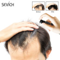 Sevich 30ml Hair Growth Essence Spray Hair Lose Liquid Damaged Hair Repair Growing Original Authentic Hair Loss Treatment