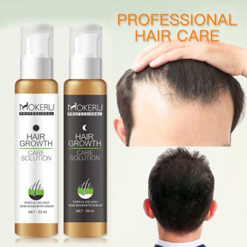 2Packs/lot Professional Hair Care Growth Essence Hair Loss Liquid Anti Baldness Day Night Use Hair Regrowth Lotion For Men Women